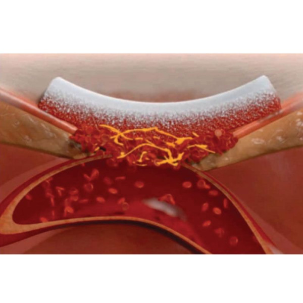 Burete hemostatic SMI-SPON STANDARD x 1 bc