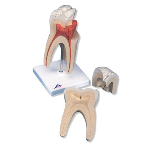 Molar Superior Cu Radacina Tripla D 10