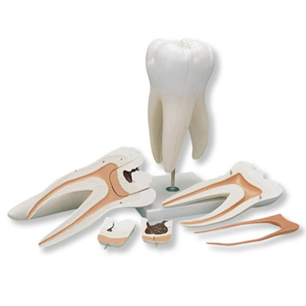 Molar  Gigant D 15