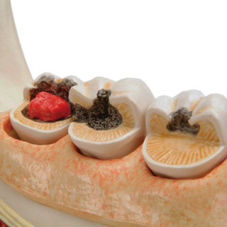 Jumatatea Inferioara A Mandibulei 2